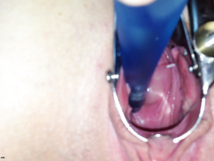 Парень через вагинальный расширитель рассматривает манду благоверной