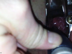 Парень через вагинальный расширитель рассматривает манду благоверной